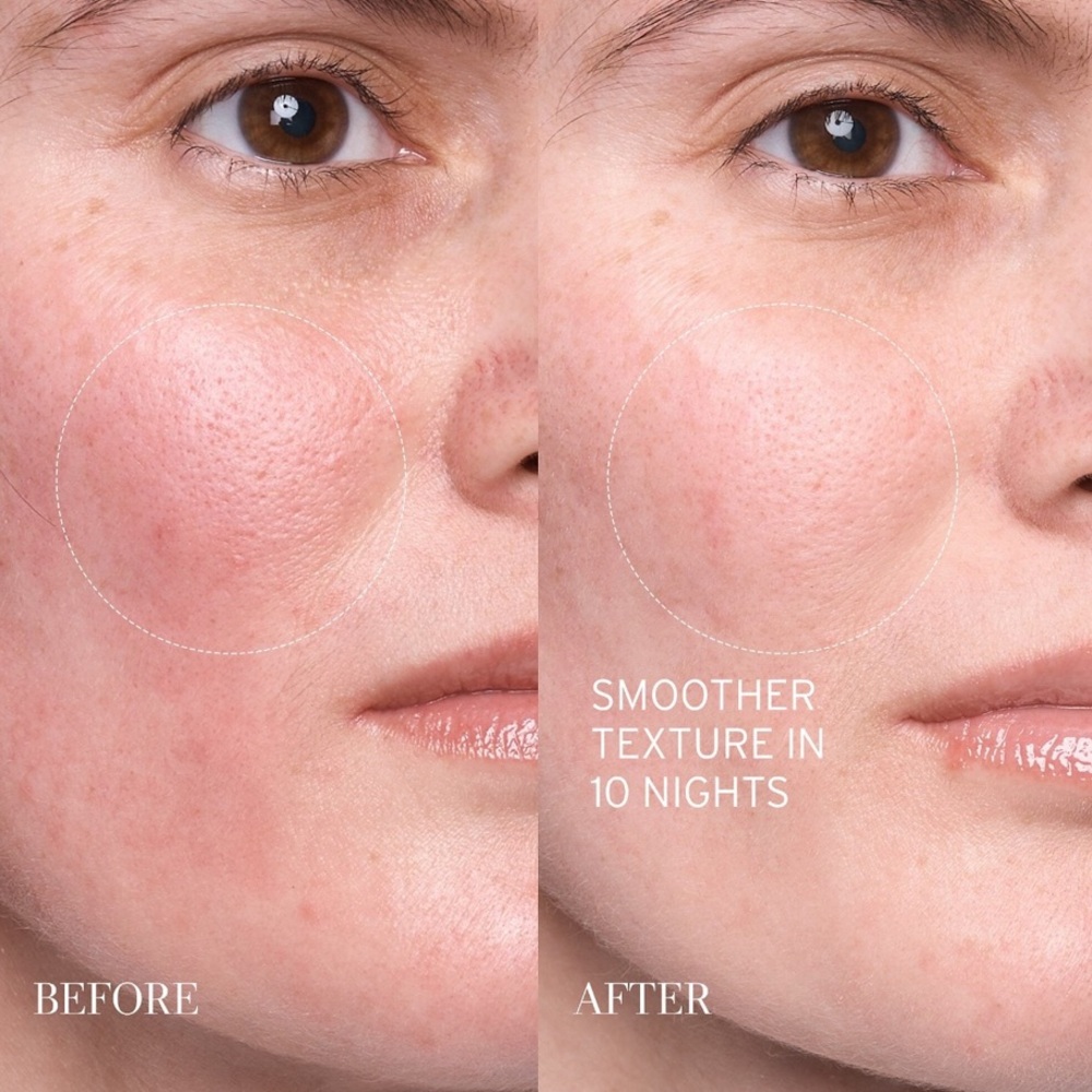 🪷 Fresh Lotus Youth Preserve Resurfacing Dream Serum - Picture 3 of 8